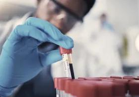 Scientist preparing biological samples