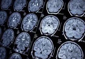 Multiple brain scan images